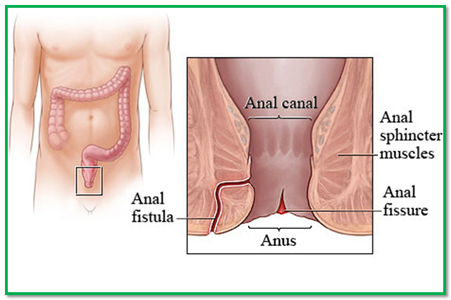 Self infected anus cut liver